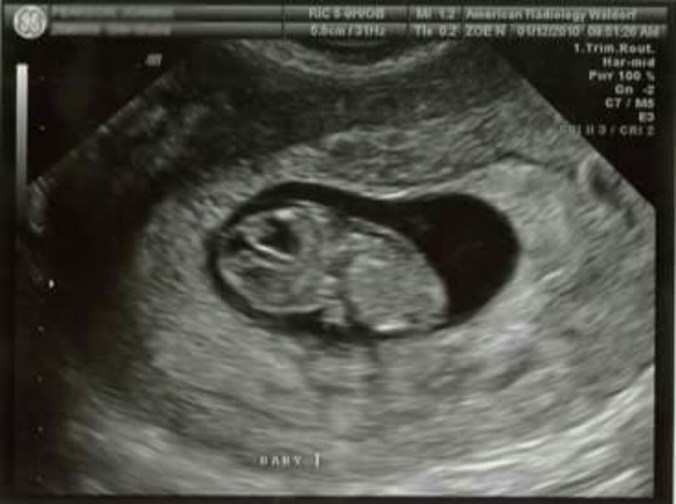 Point Blur_Jan122016_194622-2