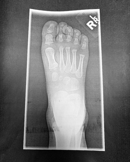 img_20170219_215828_127